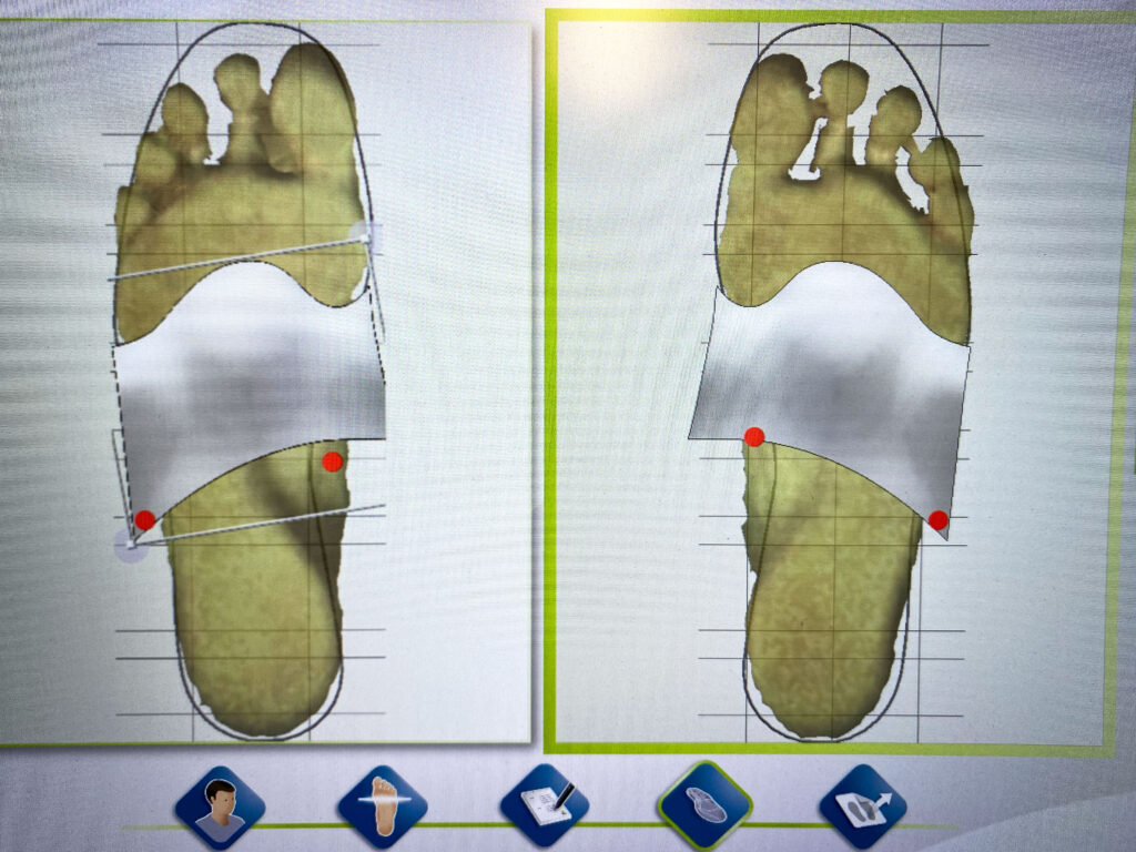 podologie-podologue-podoscope-scan3D-lepuyenvelay