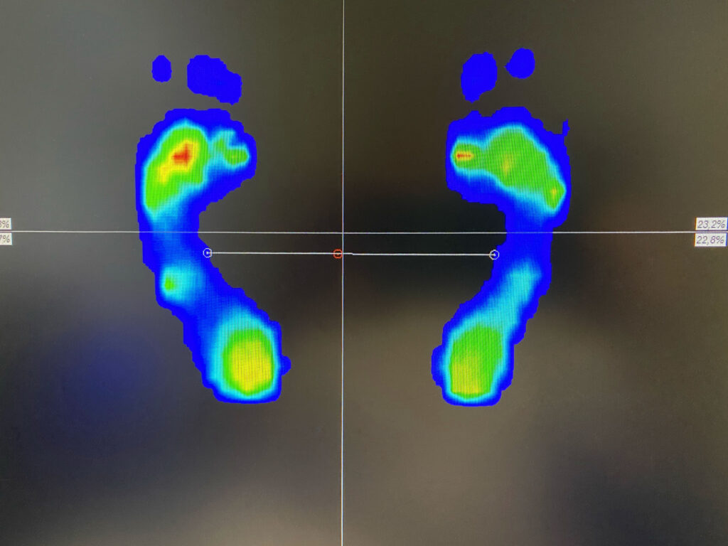 podoscope-podologie-scan3D-podologue-lepuyenvelay